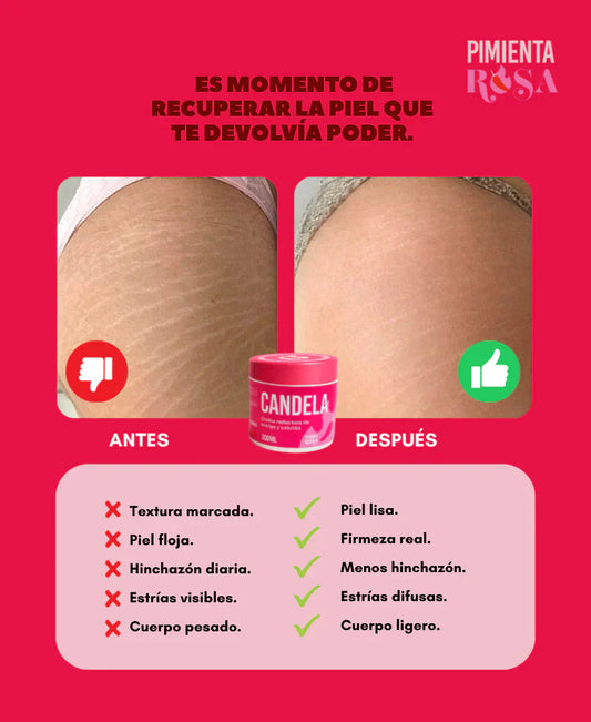El Borrador Termogénico de Estrías y Celulitis (Efecto Piel Lisa)